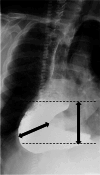 Fig. 11