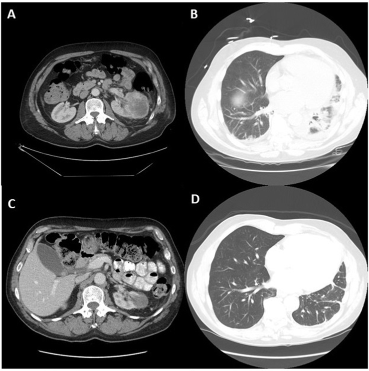 Fig. 1