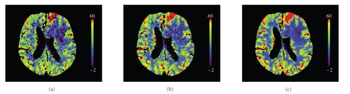 Figure 11