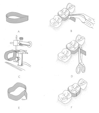 [Table/Fig-1]: