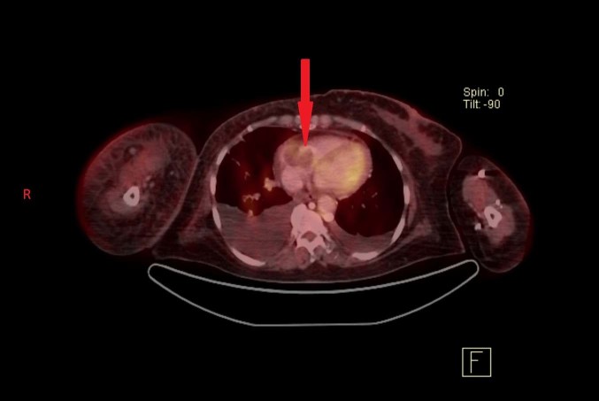 [Table/Fig-9]: