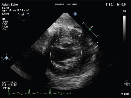 Figure 4