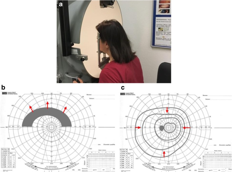 Fig. 1