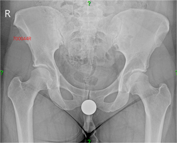 Fig. 1