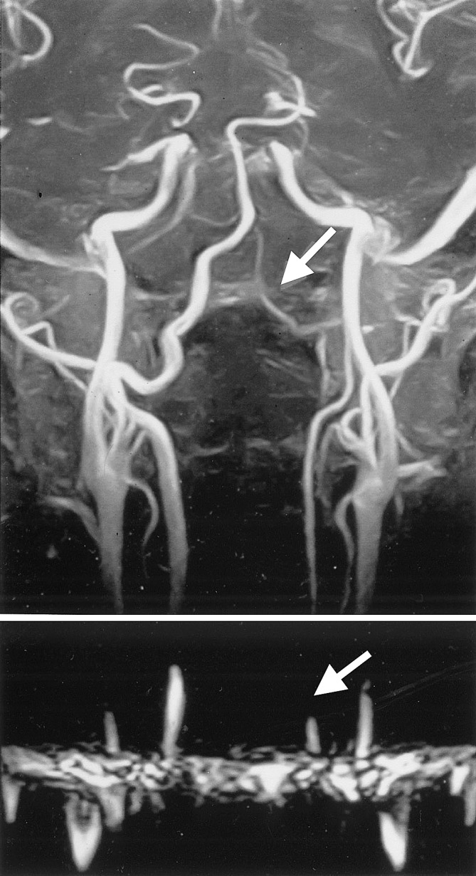 Fig. 1