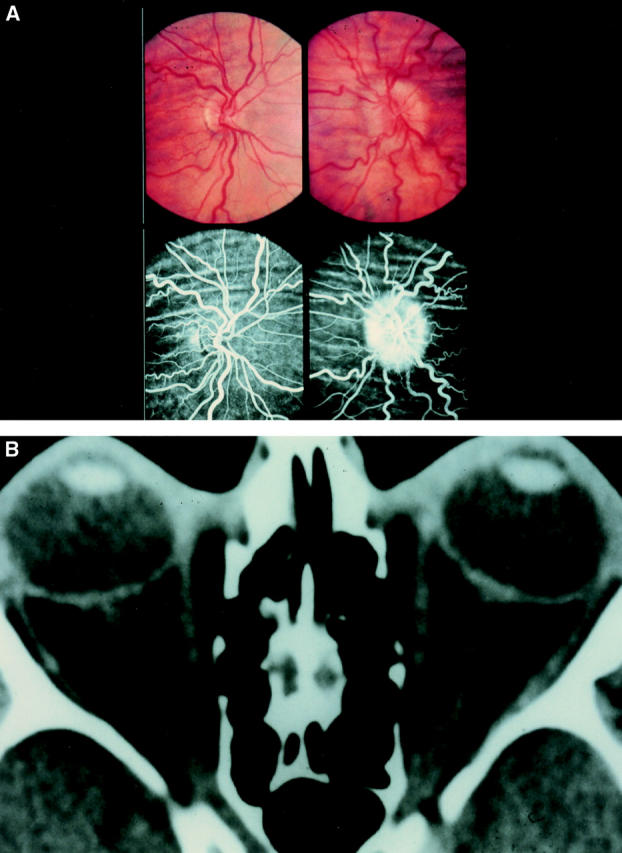 Figure 2  