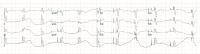 Figure 5: