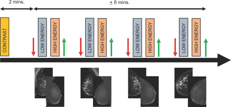 Diagram of imaging protocol for contrast-enhanced mammography. Two minutes before image acquisition, iodine-based contrast material is injected. Next, at minimum, both breasts are imaged in craniocaudal and mediolateral oblique views. In each step, compression is applied (red arrow), followed by rapid acquisition of low- and high-energy images. These images are processed to generate low-energy and recombined images. After each exposure, compression is released (green arrow). Images are considered to be of diagnostic value if they are acquired within 10 minutes after contrast material administration. mins. = minutes.