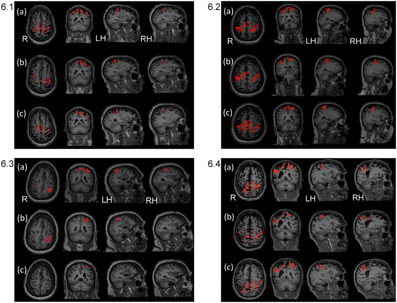 Fig 6