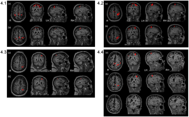 Fig 4