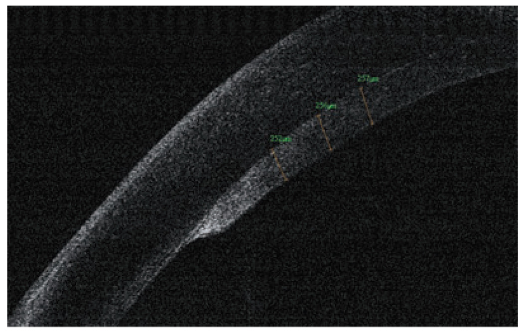 Figure 13