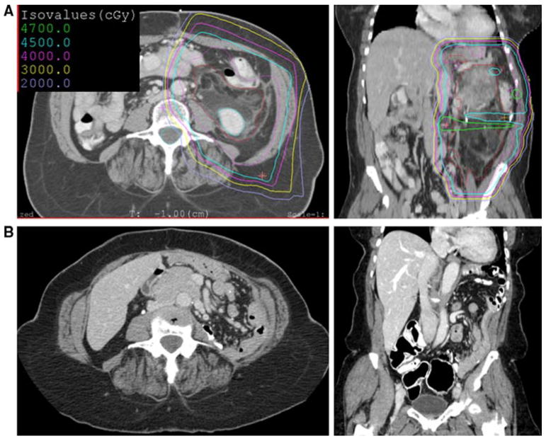 FIG. 1