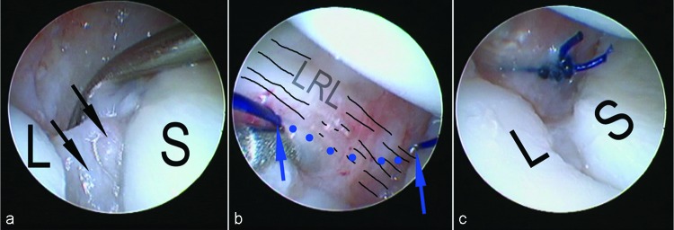 Fig. 1a–c