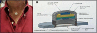 Figure 16.