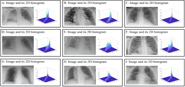 Fig. 15
