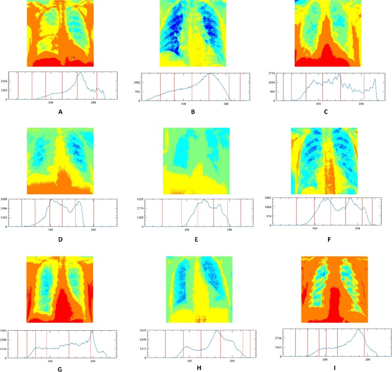 Fig B3