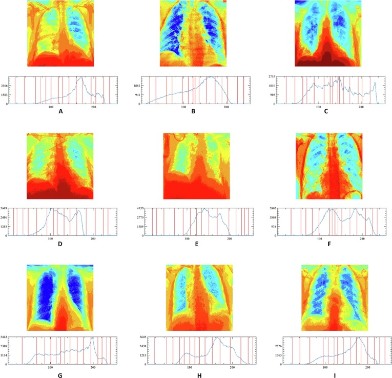 Fig. 19