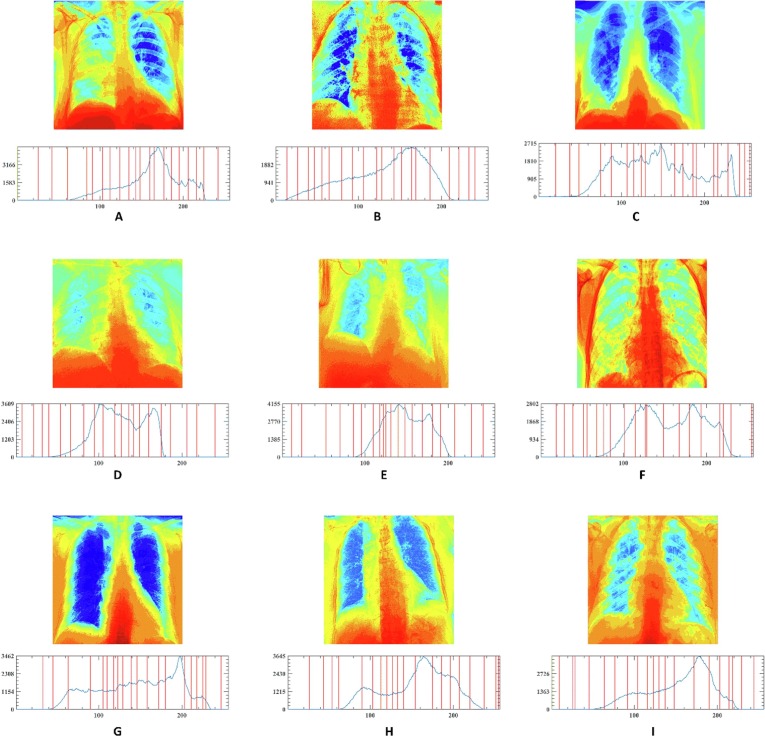 Fig. 20