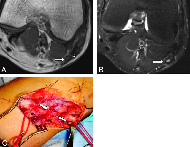 Fig 3.