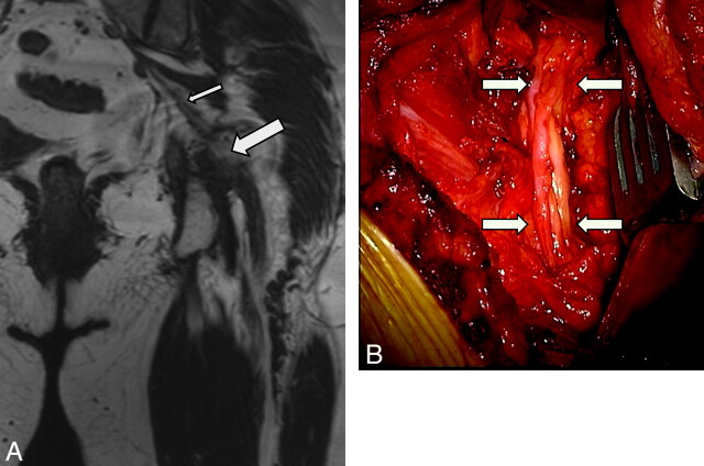 Fig 6.