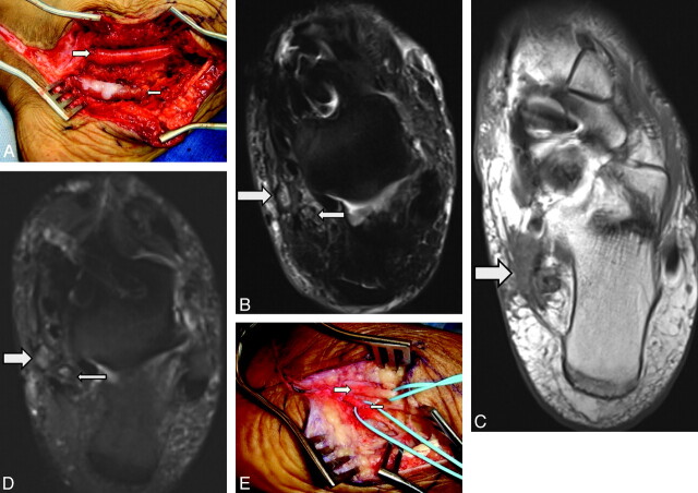 Fig 8.