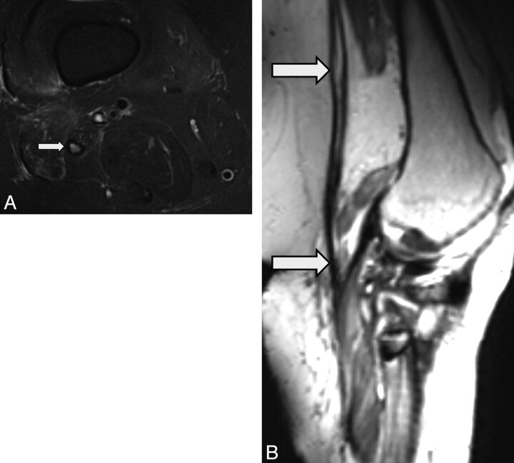 Fig 5.