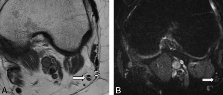 Fig 1.