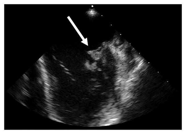 Figure 1a and b