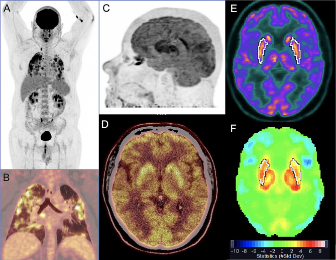 Fig. 2