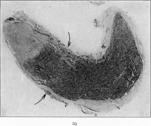 Fig. 29