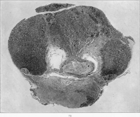 Fig. 19