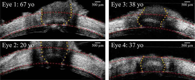 Figure 3: