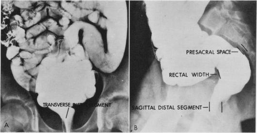 Fig. 1A and B.