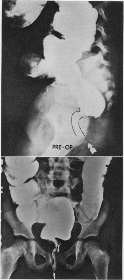 Fig. 6 A & B.