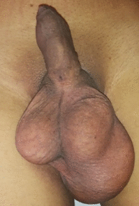 [Table/Fig-1]: