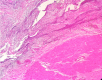 [Table/Fig-4]: