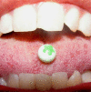 Fig. (4)