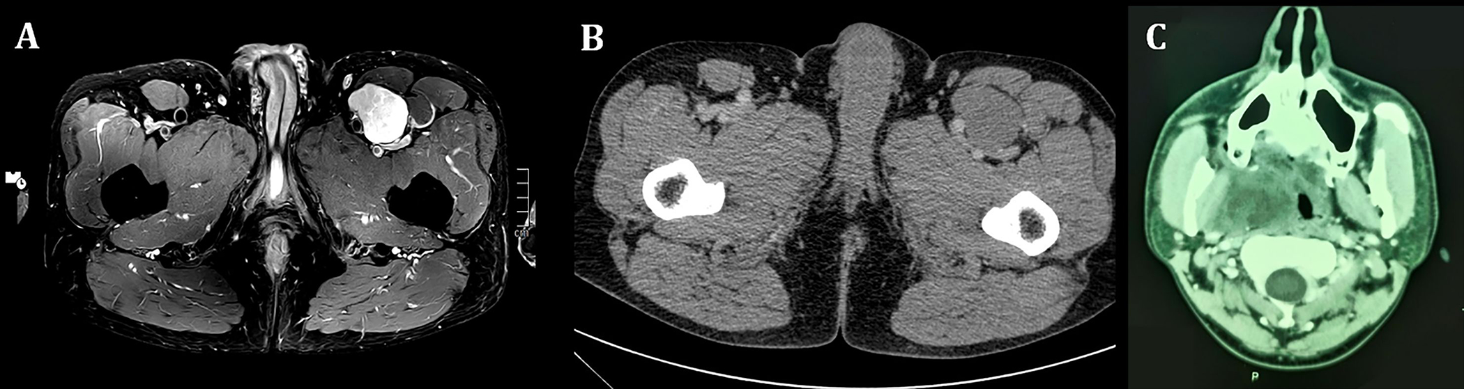 FIGURE 1