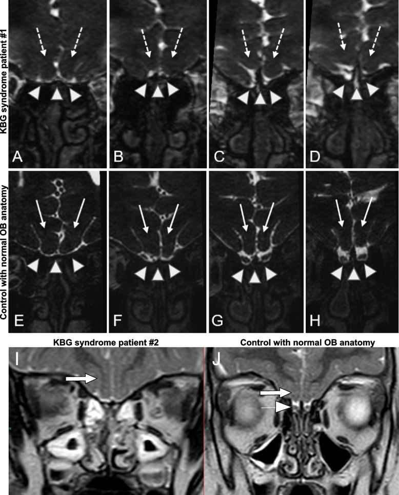 Fig. 7