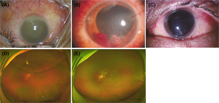 FIGURE 2