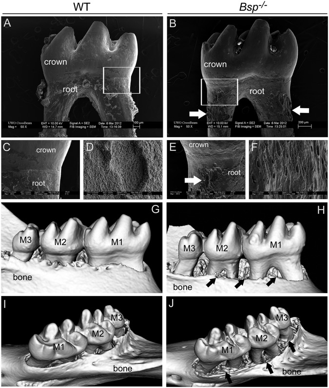 Deficiency in Acellular Cementum and Periodontal Attachment in Bsp Null ...