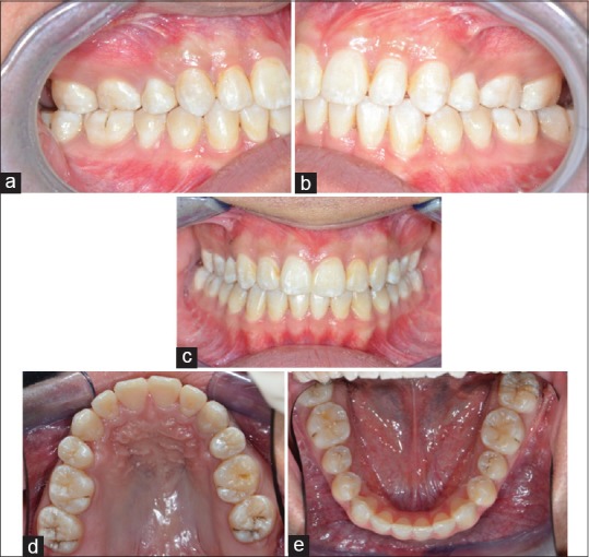 Figure 18