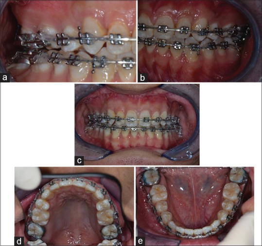 Figure 15