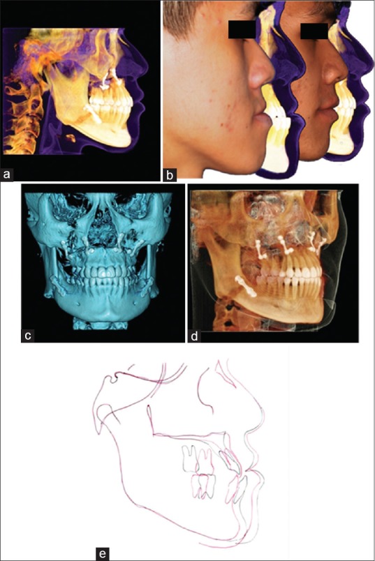 Figure 19