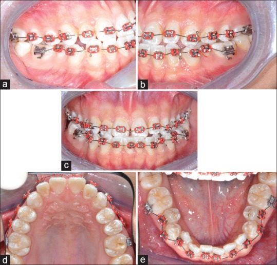 Figure 14