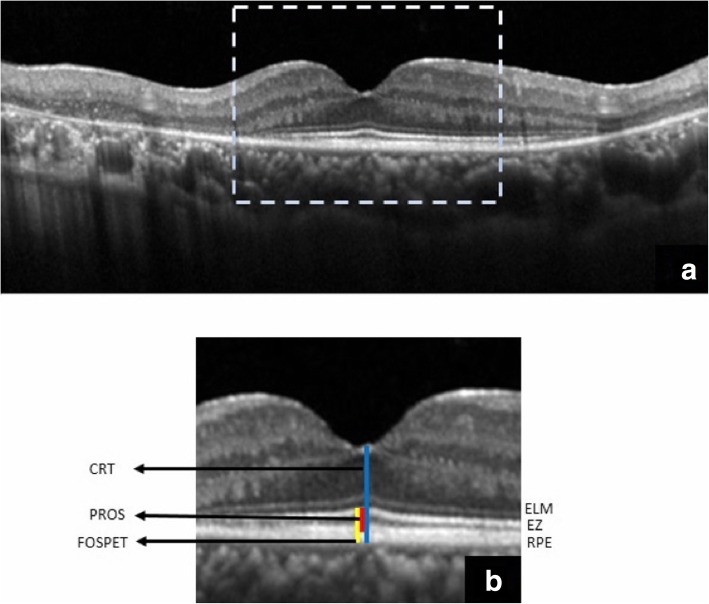 Fig. 1