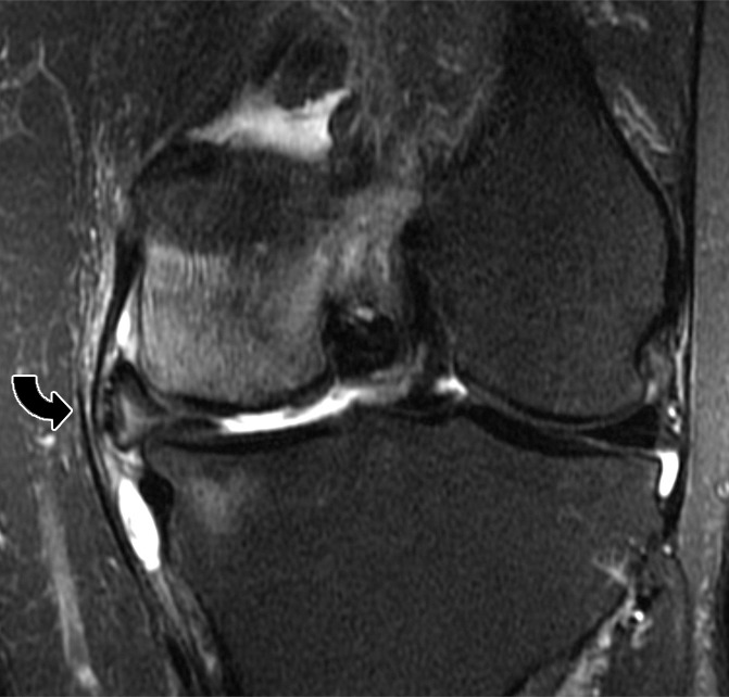 Figure 23b: