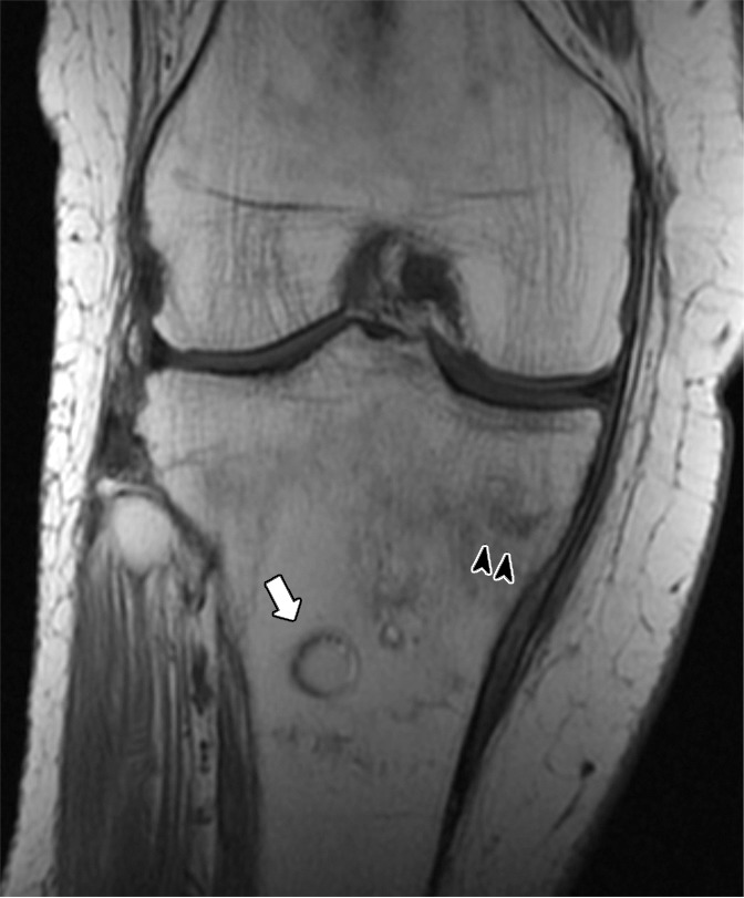 Figure 17a: