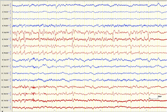 Figure 3