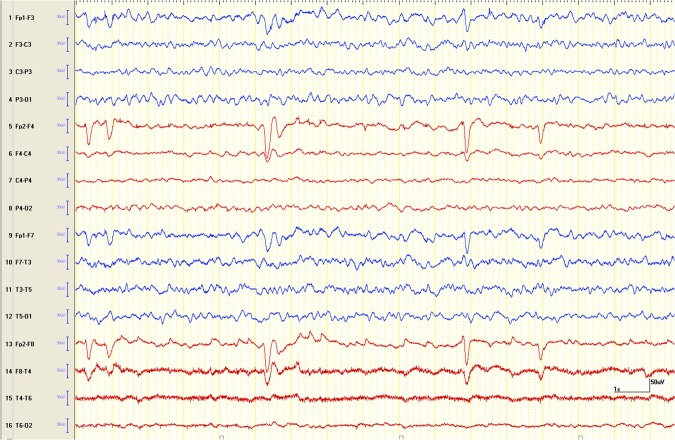 Figure 4